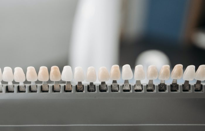 Blanqueamiento dientes Sant Feliu Sant Boi Llobregat