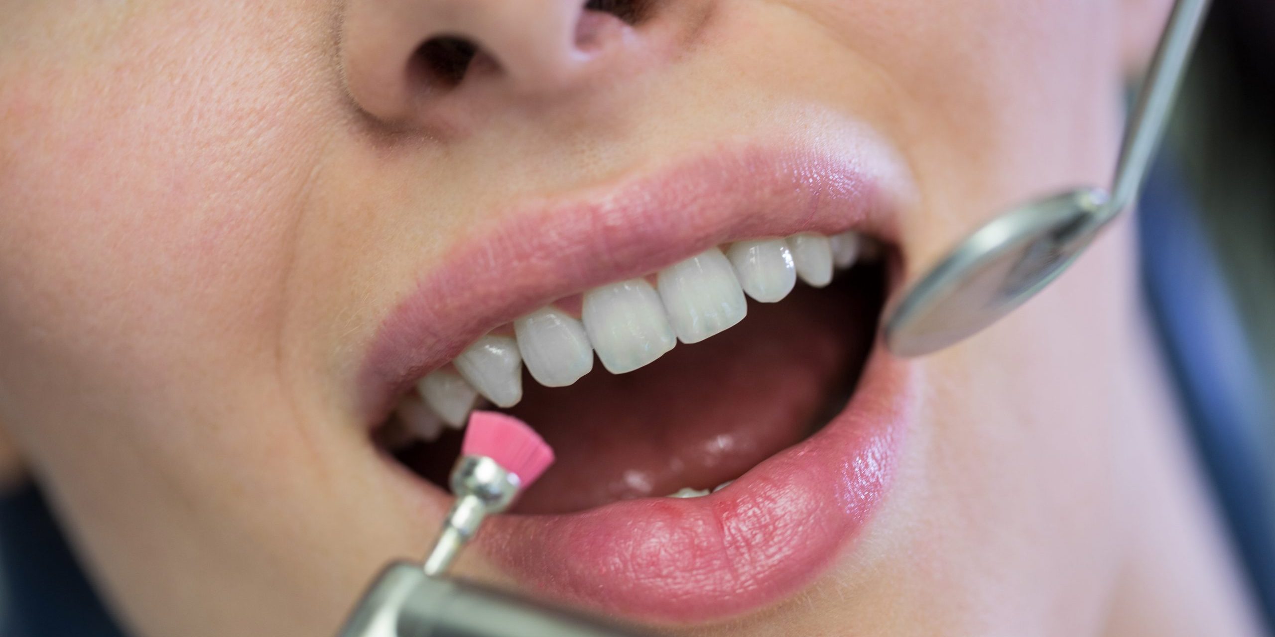 dentista limpiando