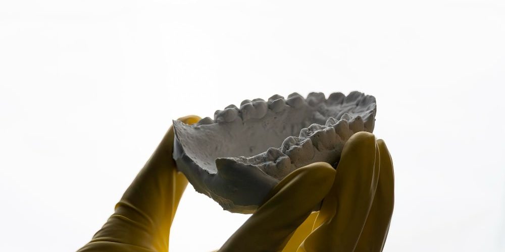 molde mandibula yeso