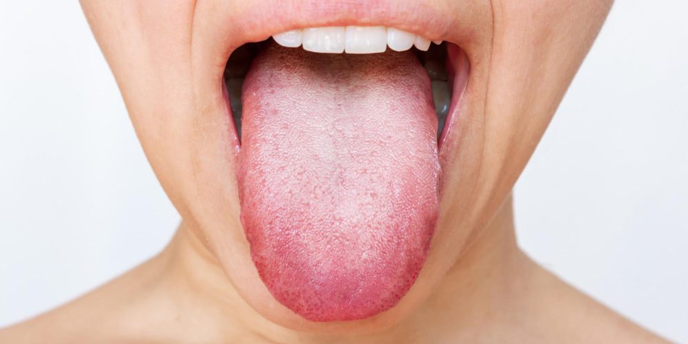 lengua blanca